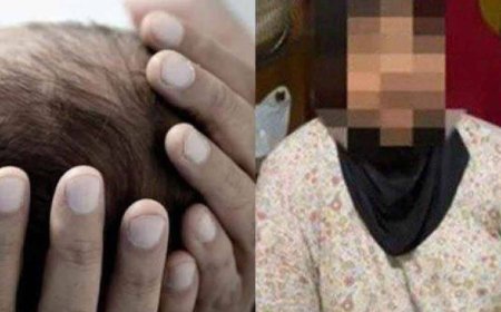 Dipaksa bersalin normal, kepala bayi songsang terputus