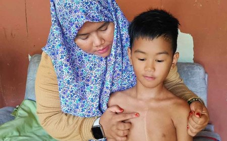RM10,000 diperlukan bagi tampung kos pembedahan jantung anak