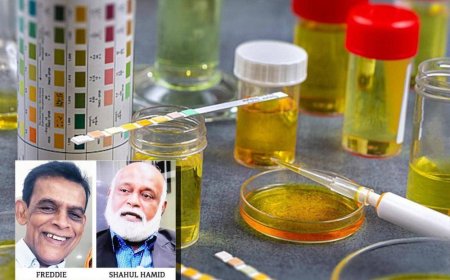 'Bayangkan 30,000 penonton beratur buat ujian air kencing'