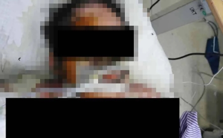 Lelaki bakar diri, kekasih hidup-hidup dekat plaza tol