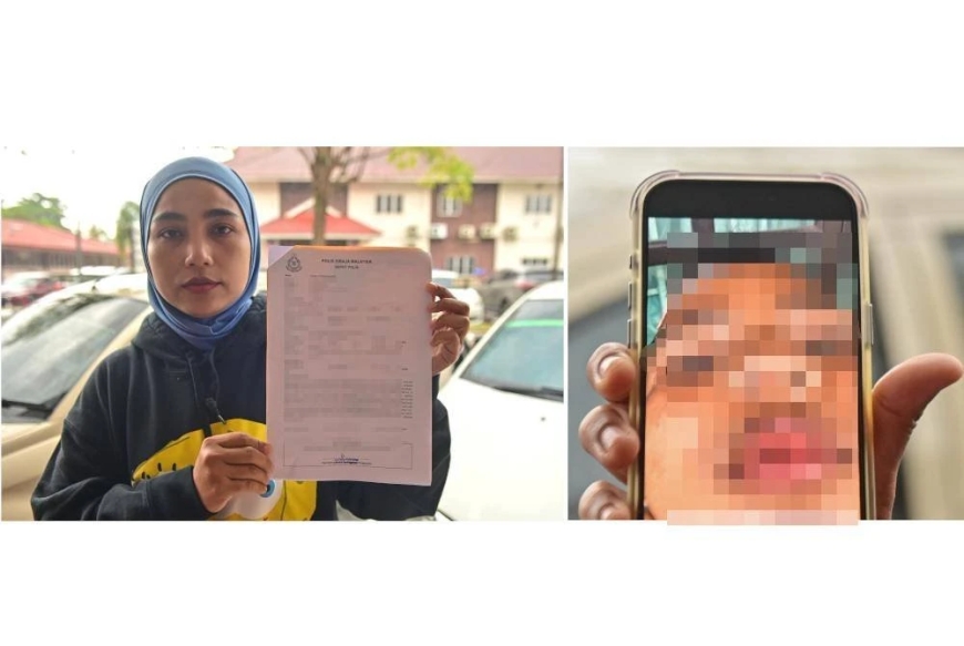 Murid Tahun Dua patah tulang hidung, retak tulang mata dakwa dipukul rakan sekolah