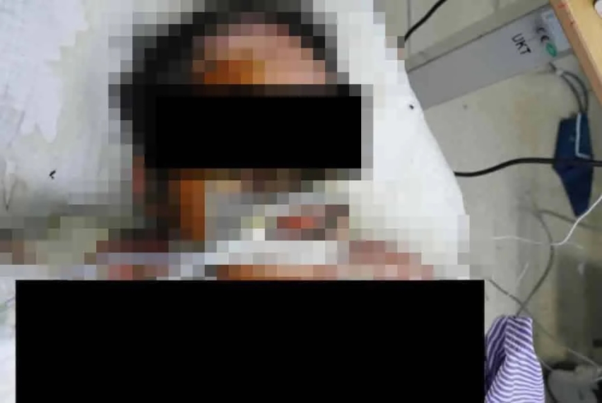 Lelaki bakar diri, kekasih hidup-hidup dekat plaza tol